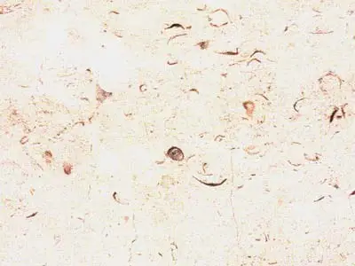 M 5326 limestone