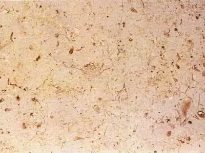 Trani Cocciolato Kalkstein, polierte Probe – Marmi di Carrara – beige, elfenbein (1)